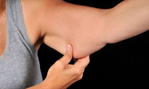 Conheça as principais causas da flacidez nos braços e saiba como tratá-la Conheça as principais causas da flacidez nos braços e saiba como tratá-la
